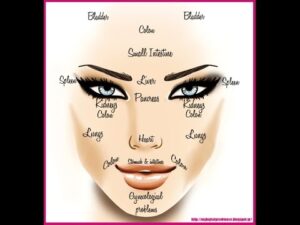 face mapping Dr Faseeha Homeopath Acne Woes