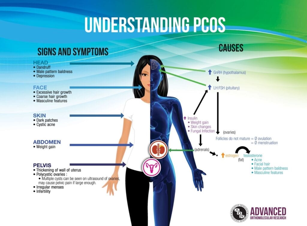 Know the Symptoms of Polycystic Ovarian Syndrome Dr Faseeha Homeopath Polycystic Ovary Syndrome